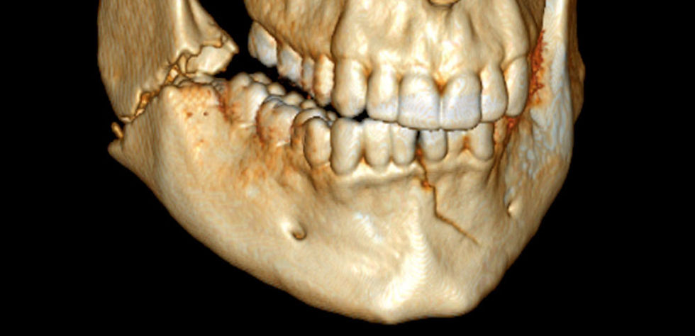 Dores Odontogenicas