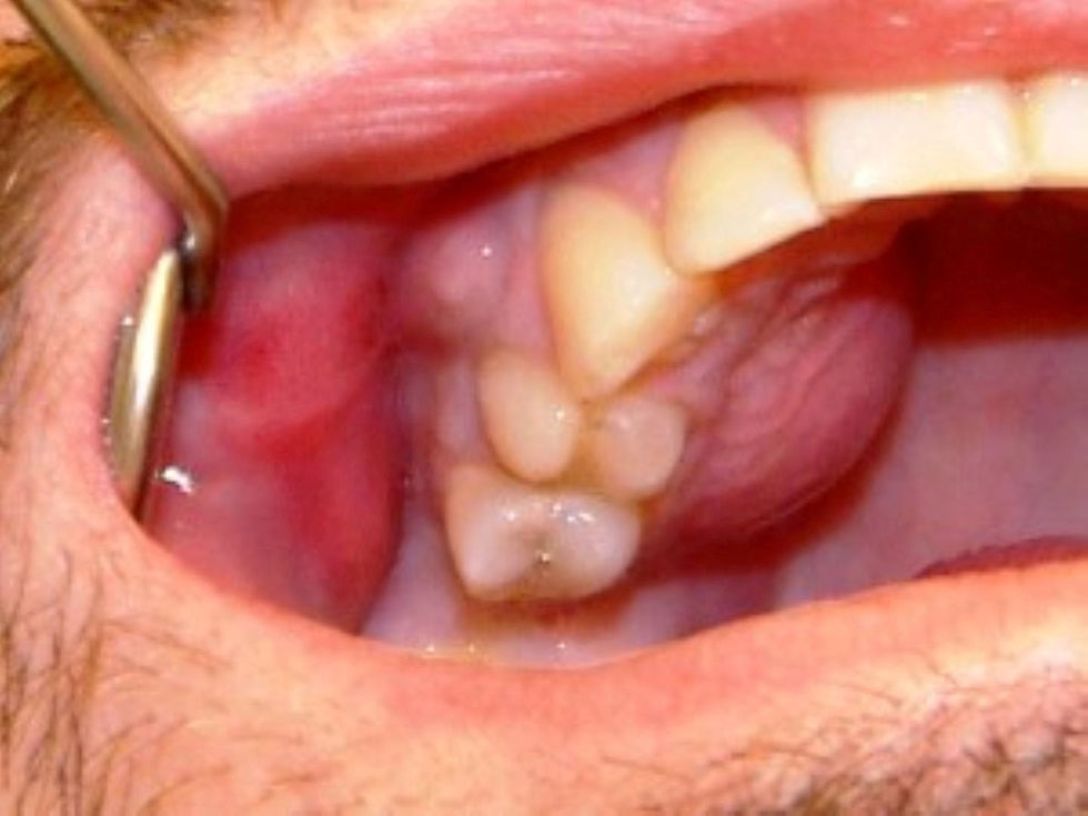 Dores Odontogenicas