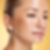 melasma skin.jpg