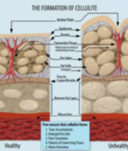 cellulite image.png