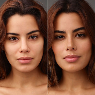 Before and After 2.jpeg