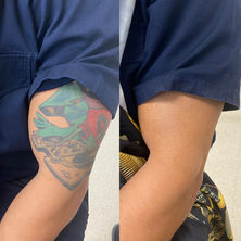 Tattoo Cover 0.JPG