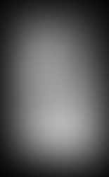 Reabsorciones radiculares, cuáles son sus causas