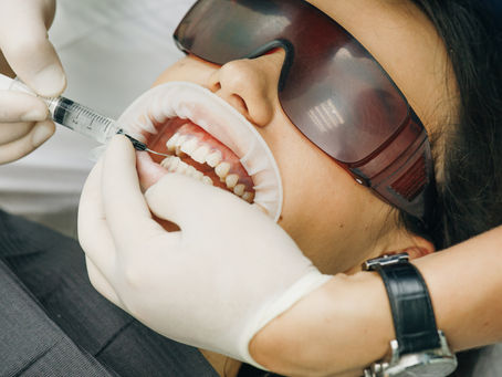 Blanqueamiento dental ¿con lámpara o sin lámpara?