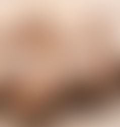 Cogumelos poderosos, aumentam a função imunológica e a saúde do cérebro e protegem-se contra o câncer