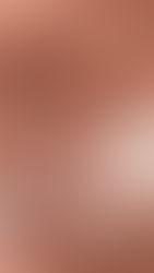 O que é uma colonoscopia? Suas perguntas, respondidas