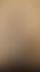 Quando o câncer deixa de ser estatística e passa a ser história