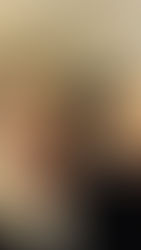 Como é realmente ter câncer?