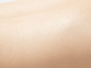 Hair Removal