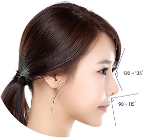 Nose Filler Singapore, Nose Contour Singapore, Nose Job non-surgical, Best Nose Filler Singapore