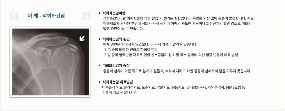 세일병원 관절 센터 어깨_석회화건염