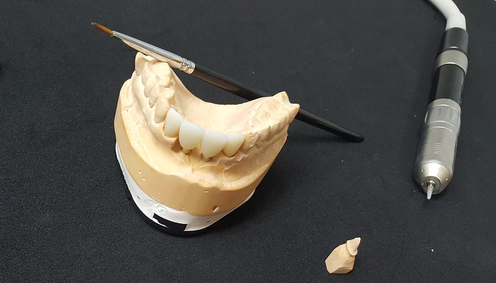 Smile Design