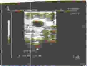Sonogram photo