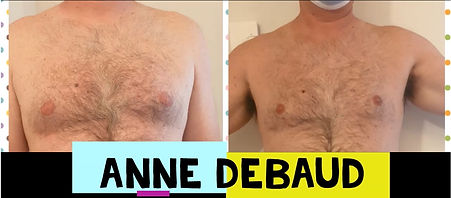 Un bel avant après