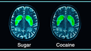 The real impact from sugar & why I decided to quit for good.