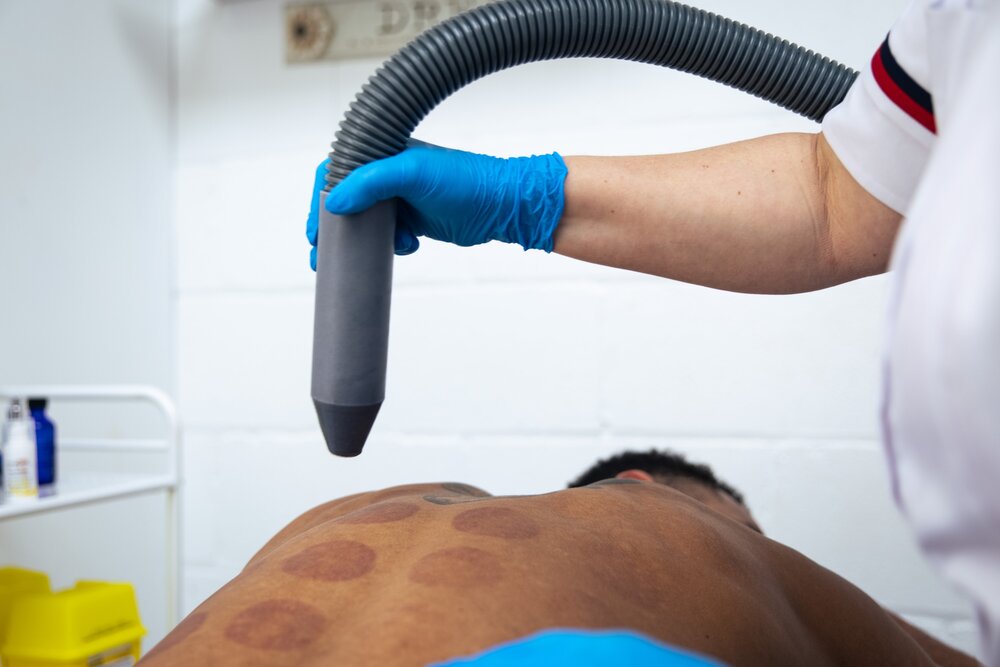 CryoSurgery treatment being performed at CryoClinic Wirral