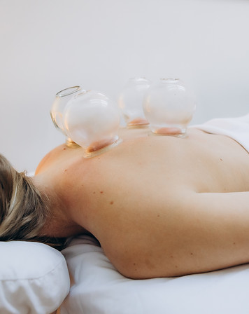 cupping cayman islands