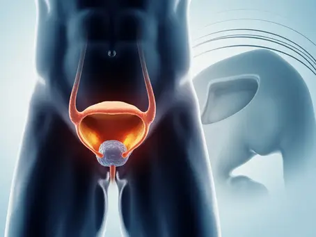 Prostatite ou adénome de la prostate : comment faire la différence et quels examens d’imagerie réaliser ? (RADIOLOGIE INTERVENTIONNELLE 78)