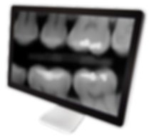 Digital dental X-ray