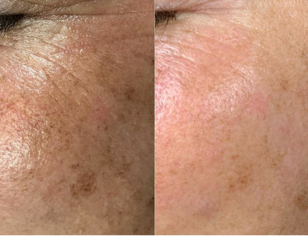 PHOTO-2021-10-14-10-25-10 6.jpg