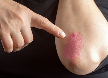 luszczycza--960x720 (1).jpg