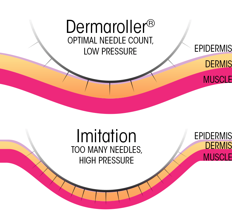 optimal-pressure.gif