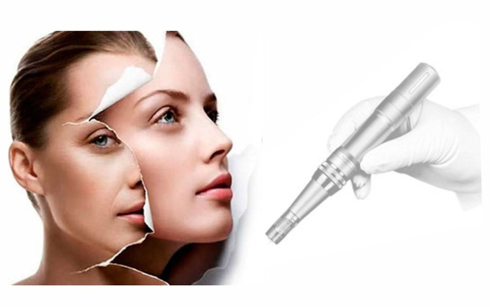 MICRONEEDLING THERAPIES