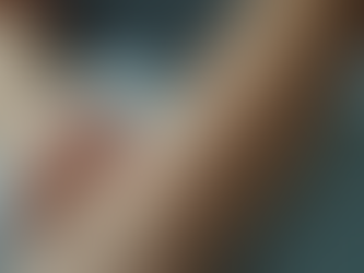 Achieve Smooth Skin with Laser Hair Removal