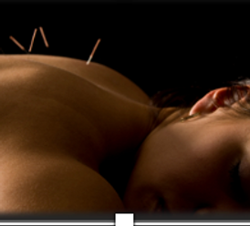 Acupuncture girl.png