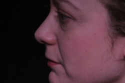 La bellezza di essere pelati