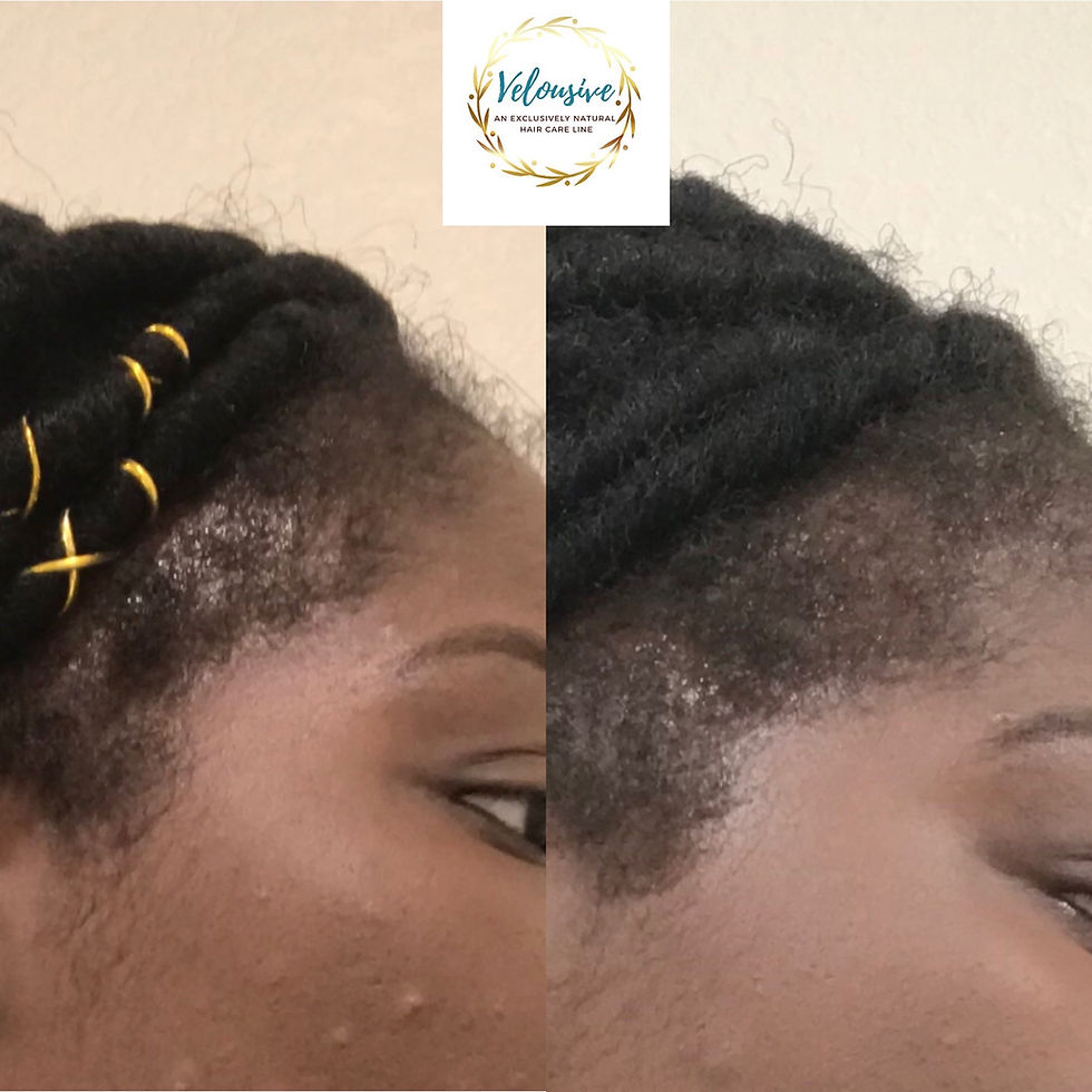 Thumbnail: Revival Oil