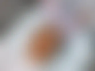 8 Things to Consider When Choosing Botox Services