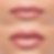 Preenchimento labial