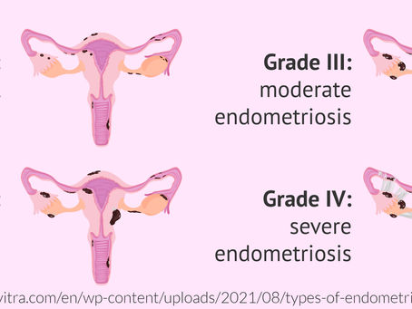 Endometriosis Awareness Month: Understanding the Reality Behind the Disease