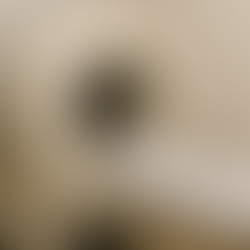 Ressonância magnética da próstata: qual a sua importância no diagnóstico do câncer de próstata?