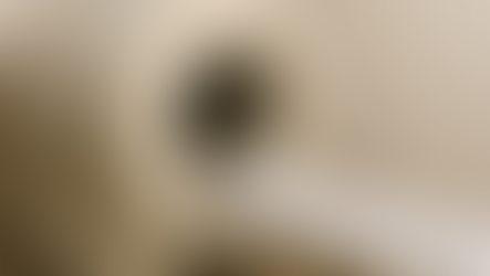 Ressonância magnética da próstata: qual a sua importância no diagnóstico do câncer de próstata?