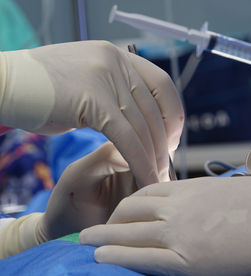 Preservação dos nervos na prostatectomia robótica: o que decide a sua potência