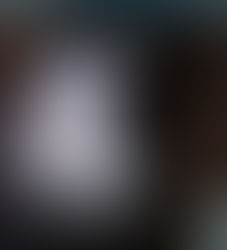 Ultrassom intraoperatório: precisão para preservar o rim