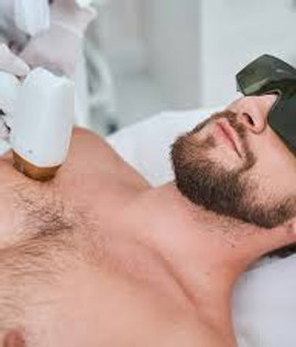 immagine di un uomo che fa epilazione laser