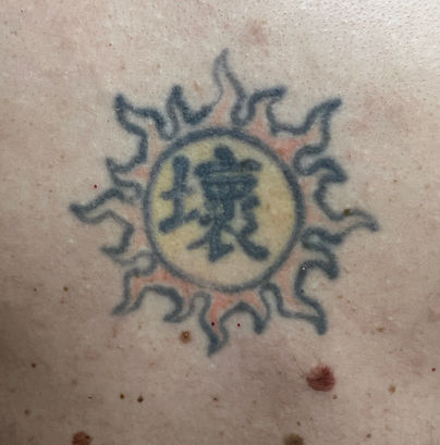 ModaraMuse Tattoo Removal.jpeg
