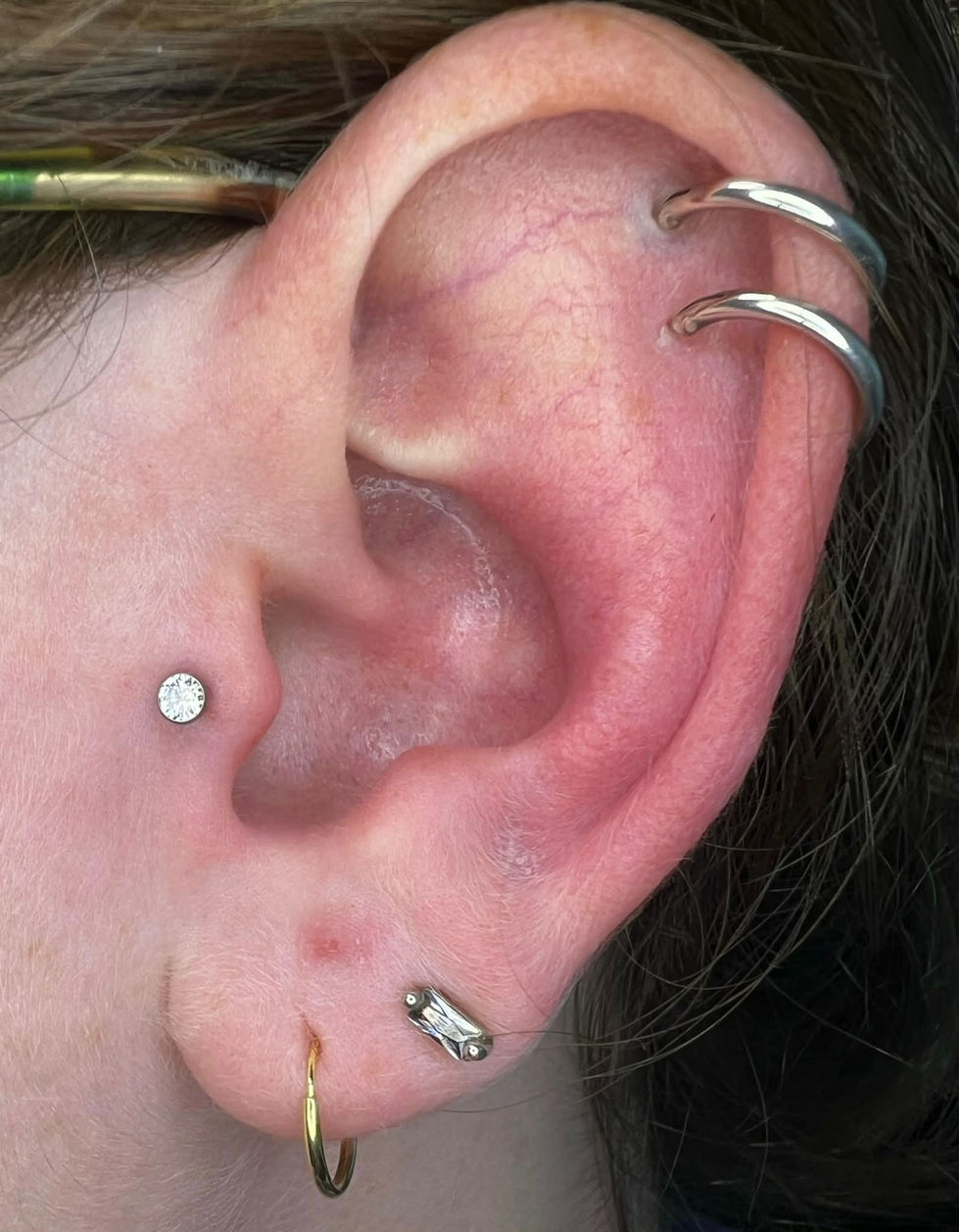 Tragus