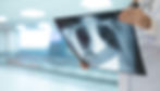 failure to diagnosis Medical Malpractice Disilivio Young Law