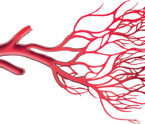 Interventional Cardiology