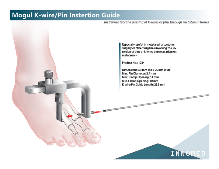 mogul k-wire extra natural pic.png