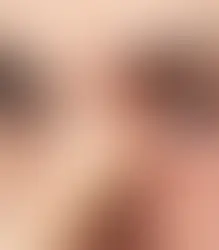 Mucous Fishing Syndrome: When a Habit Becomes a Vicious Cycle