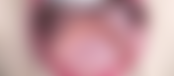 Pourquoi utiliser un gratte-langue ?