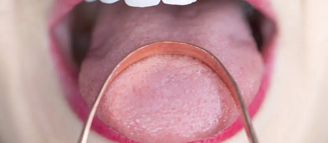 Pourquoi utiliser un gratte-langue ?