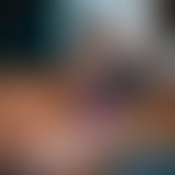 Mange in Dogs (Mites)