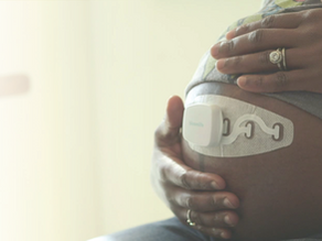 Bloomlife pregnancy tracker. Sleduj, počítaj a časuj svoje konktrakcie.