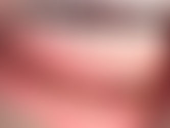 Implant-Assisted Dentures: The Modern Solution for Loose or Uncomfortable Dentures